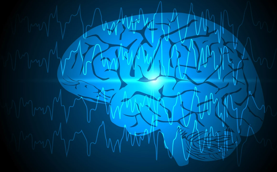 Epilepsi