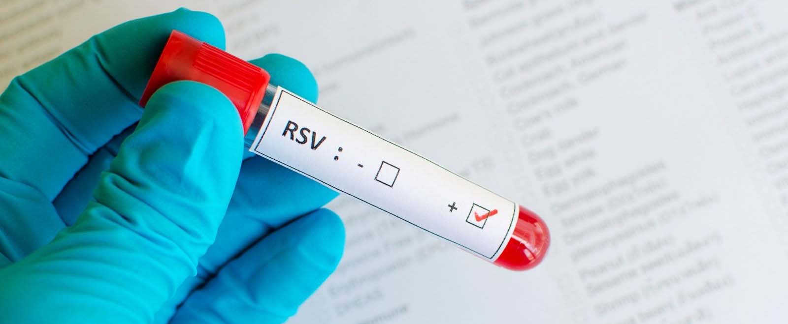 RSV virüsü
