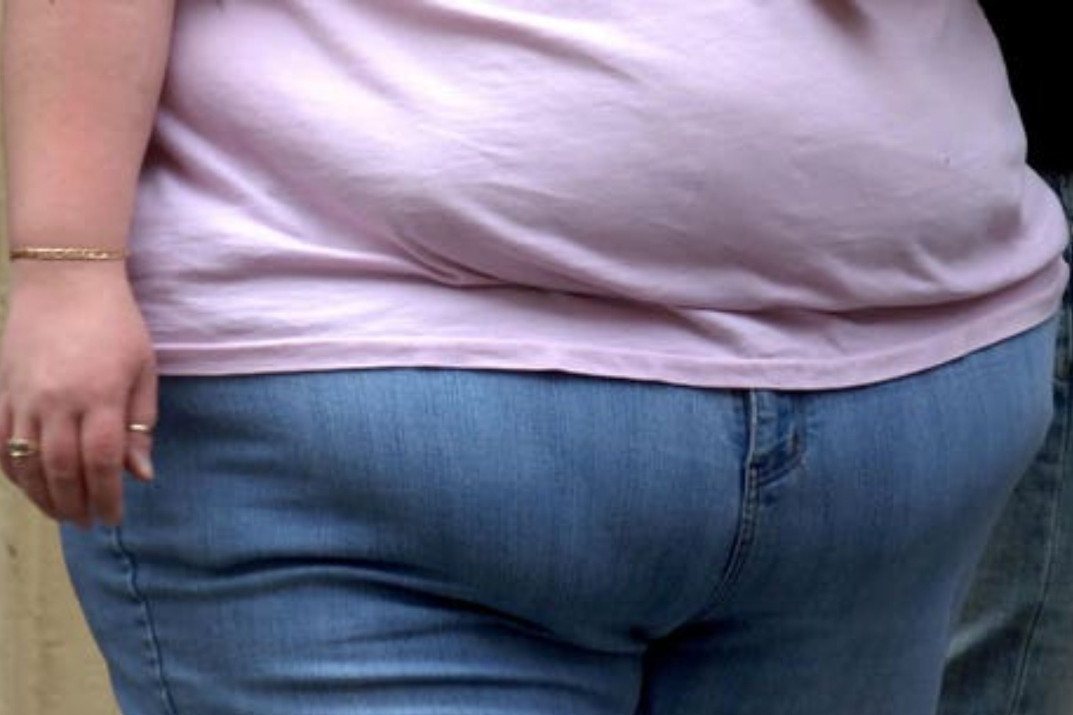 Obezite, kadınlarda kanser riskini artırıyor